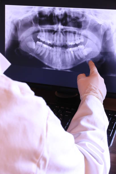 Best Emergency Dentist for Lost Fillings or Crowns in Bear Creek, AL